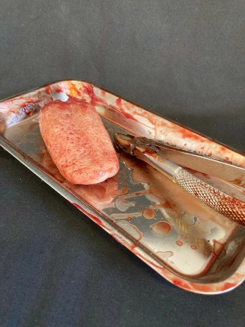Other Surgical Tray With Silicone Severed Tongue - Image 3