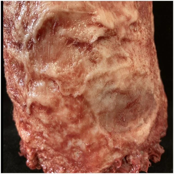 Other Silicone Burnt Arm - Image 5