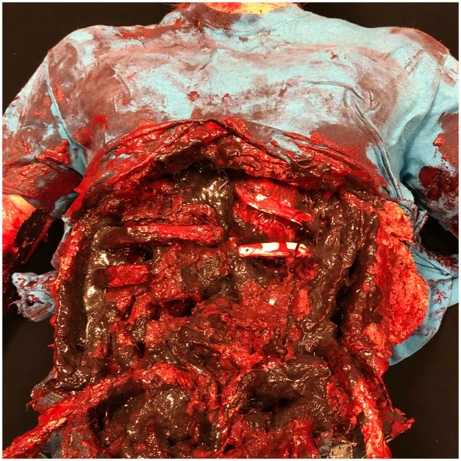 Other Messed Up Dead Body - Image 3